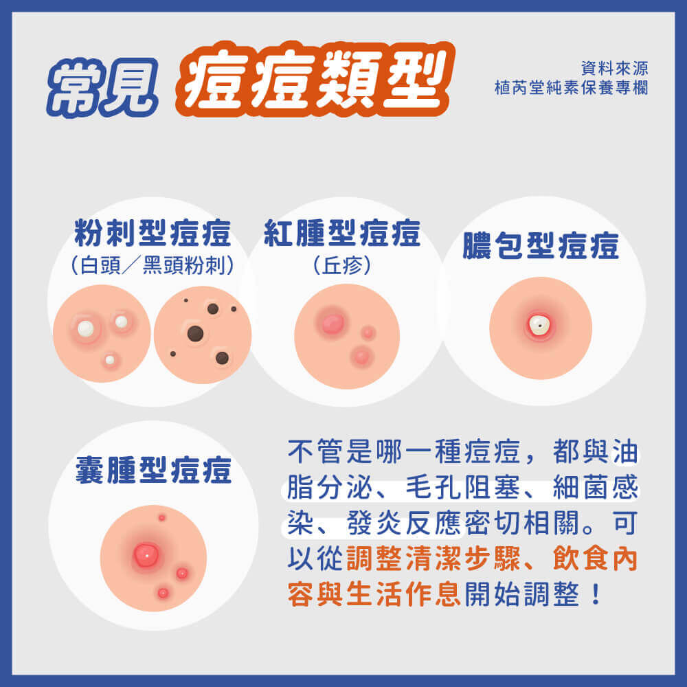 一直長痘痘？先搞懂痘痘類型才好治療！